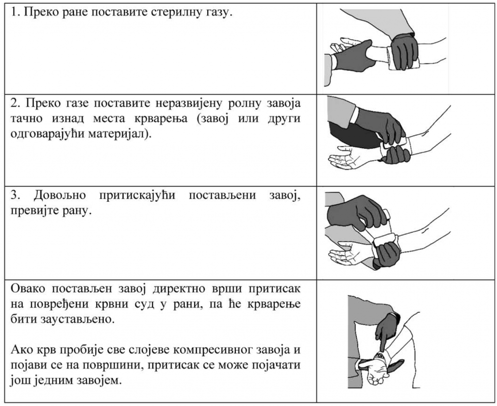 osnovni-postupci-pruzanja-prve-pomoci-kompresivni-zavoj